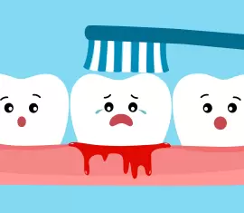 Gengiva inflamada entre os dentes: causas, sintomas e como tratar