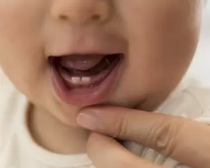Higiene bucal infantil: mitos e verdades + cuidados essenciais